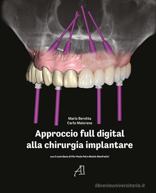 Approccio full digital alla chirurgia implantare di Carlo Maiorana, Mario Beretta edito da Ariesdue