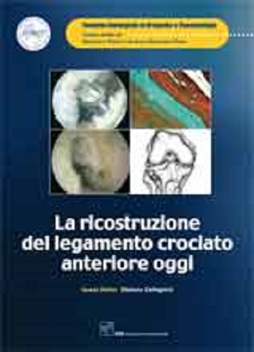 La ricostruzione del legamento crociato anteriore oggi edito da CIC Edizioni Internazionali