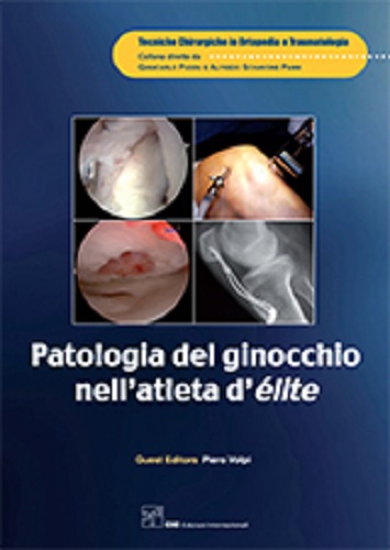 Patologia del ginocchio nell'atleta d'elite di AA.VV. edito da CIC Edizioni Internazionali