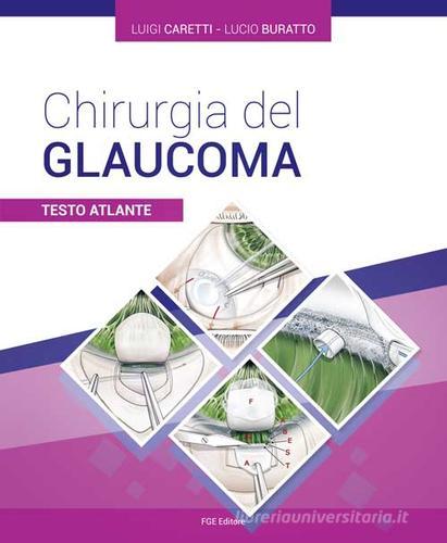 Chirurgia del glaucoma. Testo atlante di Luigi Caretti, Lucio Buratto edito da Fabiano