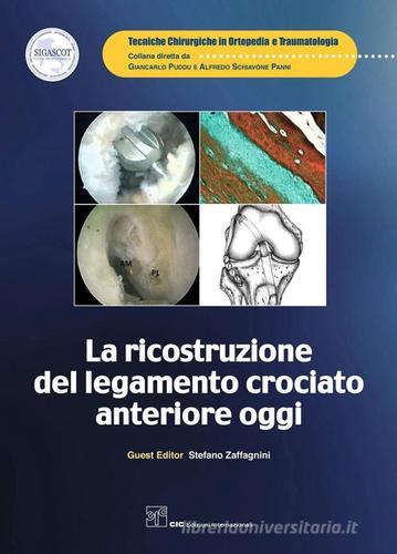 La ricostruzione del legamento crociato anteriore oggi di AA.VV. edito da CIC Edizioni Internazionali