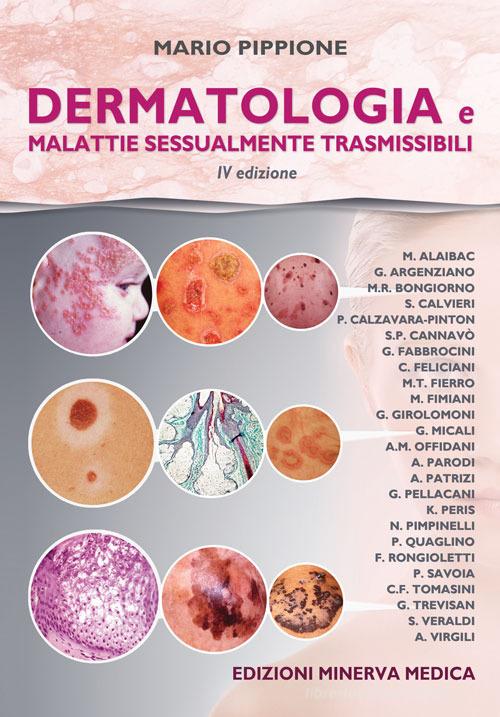 Dermatologia e malattie sessualmente trasmissibili di Mario Pippione edito da Minerva Medica