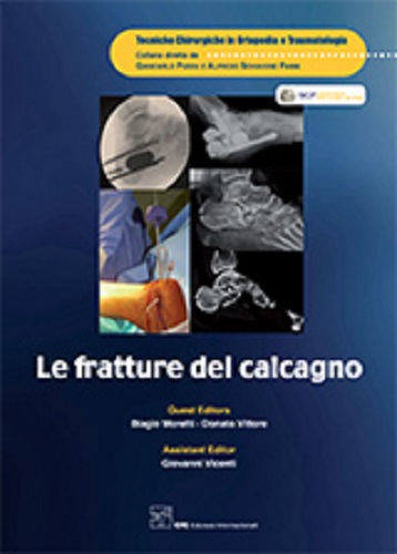 Le fratture del calcagno di Biagio Moretti, Donato Vittore edito da CIC Edizioni Internazionali