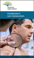 Ebook Huidkanker non-melanomen di Stichting tegen Kanker edito da Fondation contre le Cancer / Stichting tegen Kanke