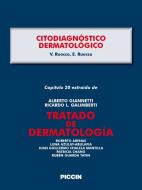 Ebook Capítulo 20 extraído de Tratado de Dermatología - CITODIAGNÓSTICO DERMATOLÓGICO di A.Giannetti, V. Ruocco, E. Ruocco edito da Piccin Nuova Libraria Spa