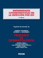 Ebook Capítulo 48 extraído de Tratado de Dermatología - ENFERMEDADES CUTANEOMUCOSAS EN LA INFECCIÓN POR HIV di A.Giannetti, E. Alessi edito da Piccin Nuova Libraria Spa