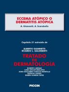 Ebook Capítulo 51 extraído de Tratado de Dermatología - ECCEMA ATÓPICO o DERMATITIS ATÓPICA di A.Giannetti, A. Scarabello edito da Piccin Nuova Libraria Spa