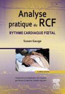 Ebook Analyse pratique du RCF di Susan Gauge, Bruno Carbonne, Christine Henderson, Amélie Nguyen edito da Elsevier Masson