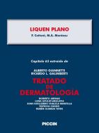 Ebook Capítulo 65 extraído de Tratado de Dermatología - LIQUENPLANO di A.Giannetti, F. Cottoni, M.A. Montesu edito da Piccin Nuova Libraria Spa