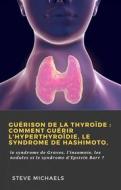 Ebook Guérison De La Thyroïde : Comment Guérir L'hyperthyroïdie, Le Syndrome De Hashimoto, di Doug Fredrick edito da Babelcube Inc.