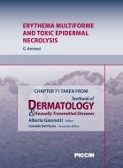 Ebook Chapter 71 Taken from Textbook of Dermatology & Sexually Trasmitted Diseases - ERYTHEMA MULTIFORME AND TOXIC EPIDERMAL NECROLYSIS di A.Giannetti, G. Annessi edito da Piccin Nuova Libraria Spa