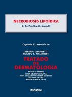 Ebook Capítulo 73 extraído de Tratado de Dermatología - NECROBIOSIS LIPOÍDICA di A.Giannetti, G. De Panfilis, M. Marcelli edito da Piccin Nuova Libraria Spa