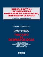 Ebook Capítulo 78 extraído de Tratado de Dermatología - HIPERQUERATOSIS EPIDERMOLÍTICAS, ENFERMEDAD DE HAILEY-HAILEY, ENFERMEDAD DE DARIER di A.Giannetti, G. Tadini, L. Restano Cassulino edito da Piccin Nuova Libraria Spa
