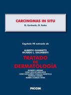 Ebook Capítulo 90 extraído de Tratado de Dermatología - CARCINOMAS IN SITU di A.Giannetti, D. Cerimele, R. Satta edito da Piccin Nuova Libraria Spa