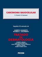 Ebook Capítulo 92 extraído de Tratado de Dermatología - CARCINOMA BASOCELULAR di A.Giannetti, C. Crosti, G. Annessi edito da Piccin Nuova Libraria Spa