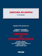 Ebook Capítulo 98 extraído de Tratado de Dermatología - SARCOMA DE KAPOSI di A.Giannetti, D. Cerimele edito da Piccin Nuova Libraria Spa