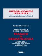 Ebook Capítulo 99 extraído de Tratado de Dermatología - LINFOMAS CUTÁNEOS DE CÉLULAS B di A.Giannetti, B. Giannotti, M. Santucci edito da Piccin Nuova Libraria Spa