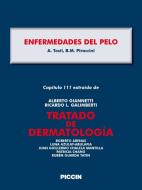 Ebook Capítulo 111 extraído de Tratado de Dermatología - ENFERMEDADES DEL PELO di A.Giannetti, A. Tosti, B.M. Piraccini edito da Piccin Nuova Libraria Spa