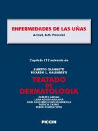 Ebook Capítulo 112 extraído de Tratado de Dermatología - ENFERMEDADES DE LAS UÑAS di A.Giannetti, A.Tosti, B.M. Piraccini edito da Piccin Nuova Libraria Spa