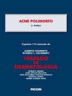 Ebook Capítulo 115 extraído de Tratado de Dermatología - ACNÉ POLIMORFO di A.Giannetti, C. Pelfini edito da Piccin Nuova Libraria Spa