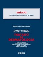 Ebook Capítulo 119 extraído de Tratado de Dermatología - VITÍLIGO di A.Giannetti, M. Picardo, M.L. Dell’Anna edito da Piccin Nuova Libraria Spa