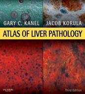 Ebook Atlas of Liver Pathology E-Book di Gary C. Kanel, Jacob Korula edito da Saunders