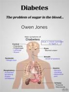Ebook Diabetes di Owen Jones edito da Tektime