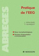 Ebook Pratique de l&apos;EEG di Jean Vion-Dury, France Blanquet edito da Elsevier Masson
