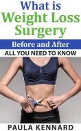 Ebook What Is Weight Loss Surgery: All You Need To Know Before And After di Paula Kennard edito da Paula Kennard