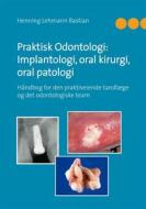 Ebook Praktisk Odontologi: Implantologi, oral kirurgi, oral patologi di Henning Lehmann Bastian Henning Lehmann Bastian edito da Books on Demand