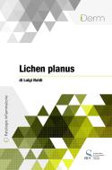 Ebook Lichen planus di Naldi Luigi edito da SICS