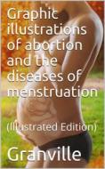 Ebook Graphic illustrations of abortion and the diseases of menstruation di Granville edito da iOnlineShopping.com