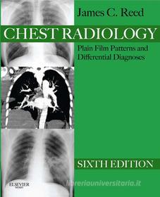 Ebook Chest Radiology Plain Film Patterns and Differential Diagnoses E-Book di James C. Reed edito da Mosby