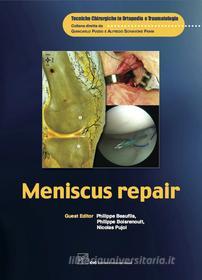 Ebook Meniscus repair di Beaufils Philippe, Boisrenoult Philippe, Pujol Nicolas edito da CIC Edizioni Internazionali