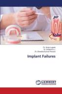 Implant Failures di Anuja Lugade, Srilakshmi J., Shwetha Kumari Poovani edito da LAP LAMBERT Academic Publishing