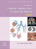 An Atlas Of Chronic Obstructive Pulmonary Disease di Trevor T. Hansel, Peter J. Barnes edito da Taylor & Francis Ltd