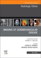 Imaging Of Cerebrovascular Disease, An Issue Of Radiologic Clinics Of North America edito da Elsevier - Health Sciences Division