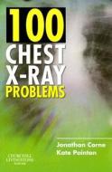 100 Chest X-ray Problems di Jonathan Corne, Kate Pointon edito da Elsevier Health Sciences