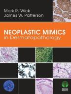 Neoplastic Mimics in Dermatopathology di Mark R. Wick edito da Demos Medical Publishing