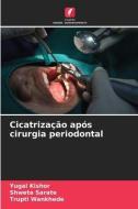 Cicatrização após cirurgia periodontal di Yugal Kishor, Shweta Sarate, Trupti Wankhede edito da Edições Nosso Conhecimento