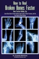How to Heal Broken Bones Faster. Bone Fracture Healing Tips: Learn About Bone Fracture Healing Foods, Types of Bone Frac di Ernesto Martinez edito da LIGHTNING SOURCE INC