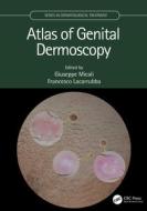 Atlas Of Genital Dermoscopy di Giuseppe Micali, Francesco Lacarrubba edito da Taylor & Francis Ltd