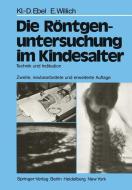 Die Röntgenuntersuchung im Kindesalter di Klaus-D. Ebel, Eberhard Willich edito da Springer Berlin Heidelberg