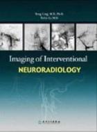 Imaging of Interventional Neuroradiology di Ling Feng edito da People's Medical Publishing House, Co. Ltd
