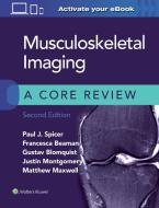 Musculoskeletal Imaging: A Core Review di Paul Spicer edito da LIPPINCOTT WILLIAMS & WILKINS