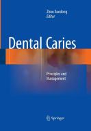 Dental Caries edito da Springer Berlin Heidelberg
