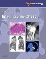 Imaging of the Chest, 2-Volume Set: Expert Radiology Series di Nestor L. Muller, C. Isabela S. Silva edito da PAPERBACKSHOP UK IMPORT