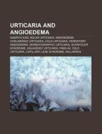 Urticaria and angioedema di Source Wikipedia edito da Books LLC, Reference Series