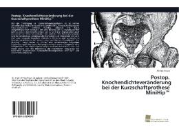 Postop. Knochendichteveränderung bei der Kurzschaftprothese MiniHip(TM) di Ahmet Ercan edito da Südwestdeutscher Verlag für Hochschulschriften AG  Co. KG