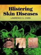 Blistering Skin Diseases di Lawrence Chan edito da CRC Press